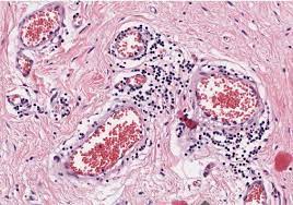 M Wegener El Iph Lehrtexte Spezielle Pathologie