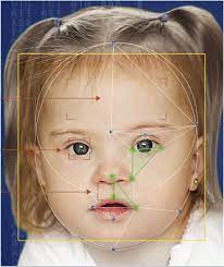 Clinical features include microbrachycephaly with a flat occiput, and characteristic facies including epicanthal folds, a flat nasal bridge. Depressed Nasal Bridge Causes Symptom Of A Rare Disease
