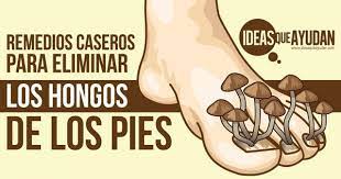 Te enseñaremos este excelente truco casero para eliminar por completo los terribles hongos de las uñas de tus pies en tiempo récord. Remedios Caseros Para Eliminar Los Hongos De Los Pies