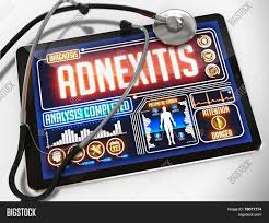 Adnexitis is a inflammatory diseases that is generally affecting the fallopian tubes and ovaries, but can also affect. Adnexitis On Display Image Photo Free Trial Bigstock