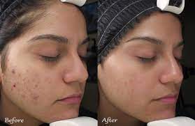 Pin En Best Skincare Tips