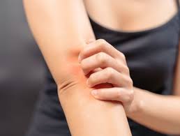 Tout Savoir Sur Les Allergies Aux Cosmetiques Doctissimo