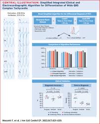 Image result for Electrocardiogram Validity