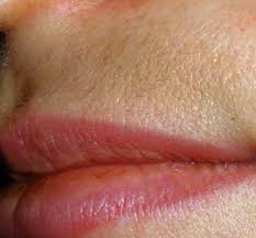 I am answering the following question written by a young woman who emailed me the following: Home Remedies For Dark Upper Lip