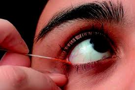 TFOS DEWS II REPORT - Diagnostic Methodology - TFOS - Tear Film ...