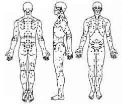 Knockout Pressure Point Chart Pressure Points