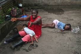 Image result for lassa fever pictures