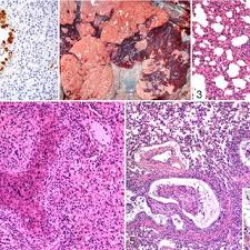 This website is a resource to help advance the understanding of the virus, inform the public, and brief policymakers in order to guide a response, improve care, and save lives. Pdf Respiratory Syncytial Virus Infection In Cattle