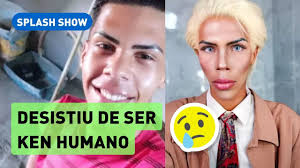 Ex-Ken humano desistiu de transformação após reconhecer distúrbio de imagem 