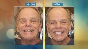 Dr. Lampee: Teeth in 24 & Ron's Story