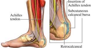 Poster Massagetherapie Ziekte