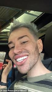 Man leaves TikTok users shocked after getting budget teeth shaving in  Turkey