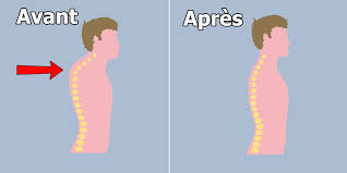 Les douleurs occasionnées n'apparaissent qu'après l'effort et atteignent leur apogée dans les 24 à 72 heures qui suivent ; Mal De Dos Un Exercice Rapide Pour Ameliorer Votre Posture Sans Effort Douleurs Dos Exercice Exercice Musculation