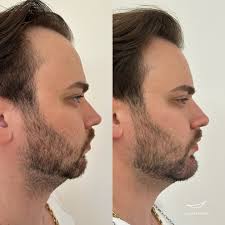 Cuidar de si é um ato de amor próprio. Não espere o “tempo certo”: crie-o.  Transforme pequenos momentos em pausas de bem-estar e lembre-se sempre,  você merece estar bem, por dentro e