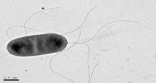 Microscope slide item # 294684. Salmonella Under The Microscope The Infectious Diseases Research Laboratory Sheba English