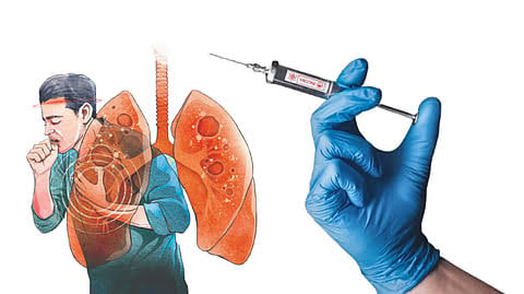 M72 TB Vaccine Partnership