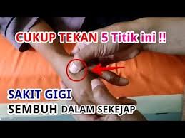 Minum obat memang mencegah keluarnya darah, tapi tidak menghilangkan stress dan gangguan. Sakit Gigi Langsung Sembuh Seketika Cukup Tekan 5 Titik Pijat Refleksi Ini Youtube Pijat Terapi Kesehatan Anak