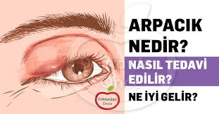 Arpacik Nedir Movie Posters Movies