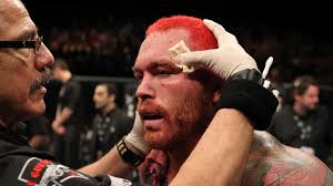 As UFC antitrust payouts roll in, fighters face relief, regret and  complicated reckonings