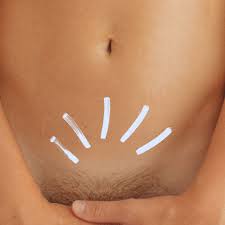 Why Do We Have Pubic Hair? | Glamour