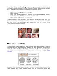 Hati nurani berbeda dengan emosi atau pikiran yang muncul akibat persepsi indrawi atau refleks secara langsung, seperti misalnya tanggapan sistem saraf simpatis. Nama Obat Sipilis Atau Raja Singa