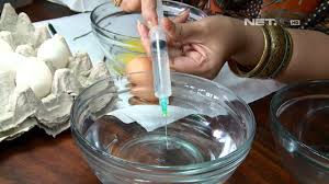 Psoriasis adalah penyakit yang tidak menular, gejala penyakit kulit psoriasis timbul. Contoh Gambar Mewarnai Cangkang Telur Ayam Kataucap