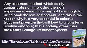 Natural Vitiligo Treatment System Michael Dawson And Natural Treatment Of Vitiligo Video Dailymotion