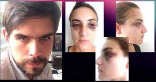 Profesor universitario es acusado por su novia, de maltrato