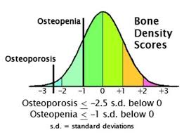 Pin On Ota Pintrest Ostenoporosis