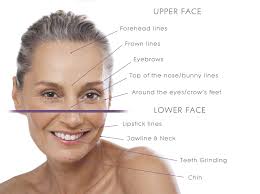The good news is that it begins working within several days of the injection. Where On The Face Can Botox Be Injected The Cosmetic Skin Clinic