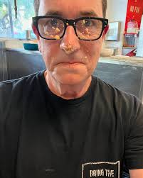 Who says cooking isn't a hazardous occupation?