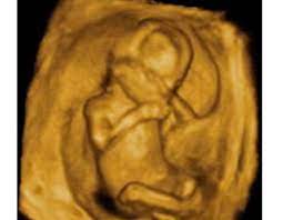 Embarazo Semana 15 El Bebe Crece Y Dobla Su Peso Natalben