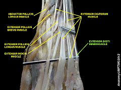 Extensor digiti minimi is a long slender skeletal muscle situated in the posterior compartment of the forearm. Extensor Digiti Minimi Muscle Wikiwand