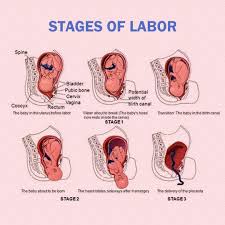 Image result for First Stage of Labor