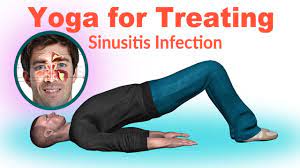 Maybe you would like to learn more about one of these? 8 Best Yoga Poses For Treating Sinusitis Infection Youtube