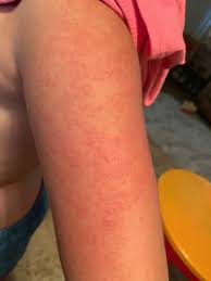 I like that it doesn't feel sticky and is made without oxybenzone and parabens, which are soon to be banned in the state of hawaii as these ingredients are damaging the coral reefs. Kids Sunscreen Spray Spf 100 Banana Boat Kids