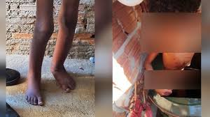 Entregue à morte, menino de 10 anos passou dois anos acorrentado com animais e se alimentava de família vivia confortavelmente enquanto criança vivenciava horror. Rbk2ytymqpbvkm