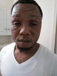 Photos: Ex-Workers allege poor conditions, unfair treatment in lawsuit