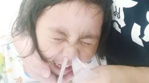 Baik karena selesma, flu, maupun alergi, hidung tersumbat bisa membuat anda sangat terganggu dan sulit produk ini sangat cocok untuk mengatasi hidung tersumbat yang disebabkan oleh selesma. Tips Mengatasi Dan Meredakan Hidung Tersumbat Kumparan Com