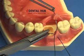 Pin On Dental Care Identalhub