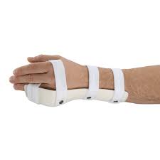 Image result for Ulnar Gutter Splint
