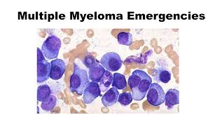 Multiple myeloma (also referred to as myeloma) is a type of rare, incurable cancer of the blood—also known as hematologic cancer. Emdocs Net Emergency Medicine Educationmultiple Myeloma Emergencies Emdocs Net Emergency Medicine Education