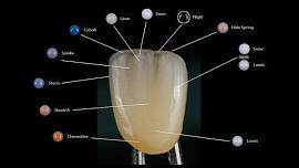 Monolithic restorations- Miyo liquid ceramic and Amann Girrbach Bion Zr