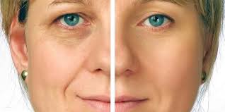 Resultado de imagen para antiaging