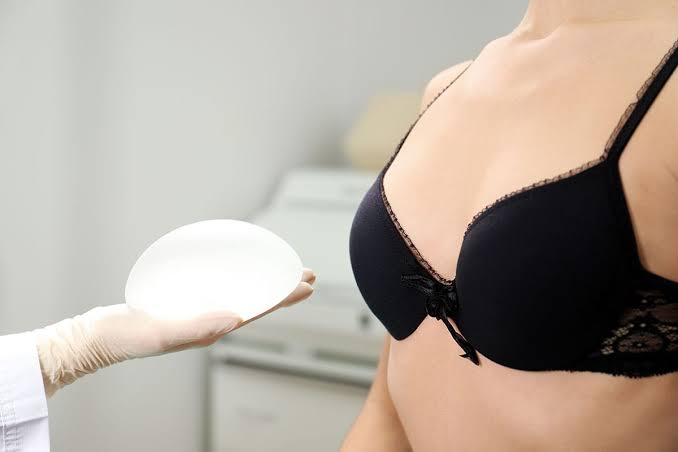 Augmentation mammaire par implants Paris - Dr HADDAD Jonathan