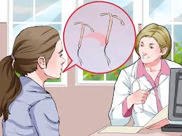 At home that night, i had the worst cramps of my life. How To Get An Iud Taken Out 9 Steps With Pictures Wikihow