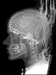 Pin On Anatomy