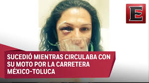 Maybe you would like to learn more about one of these? Ana Gabriela Guevara Fue Brutalmente Golpeada Youtube