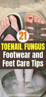 Toenail Fungus Footwear Feet Care Tips Toenail Fungus Feet Care Pedicure Tips