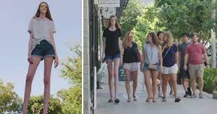 We take showers and use deodorant. Teenager Who Has The World S Longest Legs Aspires To Become A Model Small Joys